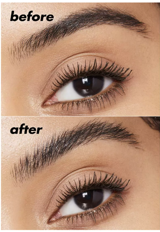 Brow Lift